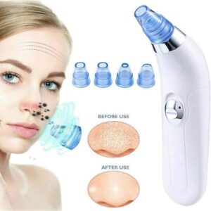 Electric Blackhead Acne Oil Remover Vacuum Suction Face Pore Cleaner Promax.pk